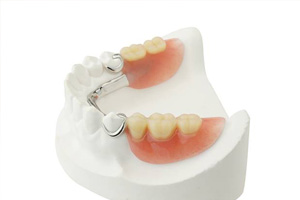 Model teeth with partial dentures
