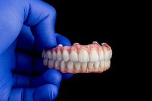 Dentist with blue gloves holding implant dentures