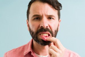 man pointing to irritated gums 