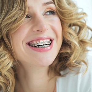 smiling woman with traditional braces in Palm Bay